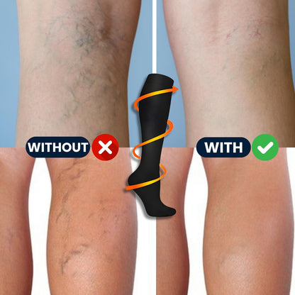 VeinoFlex - Compression Socks (Pack of 3 pairs)