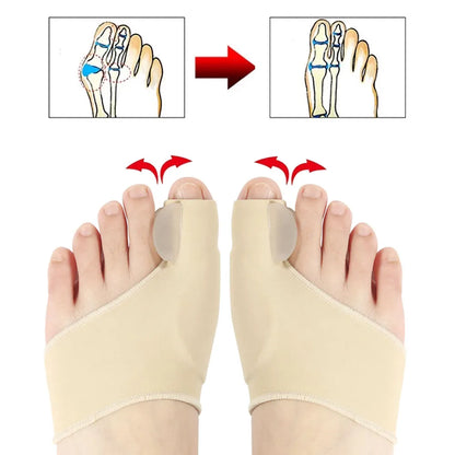 OrtoAlign® corrector